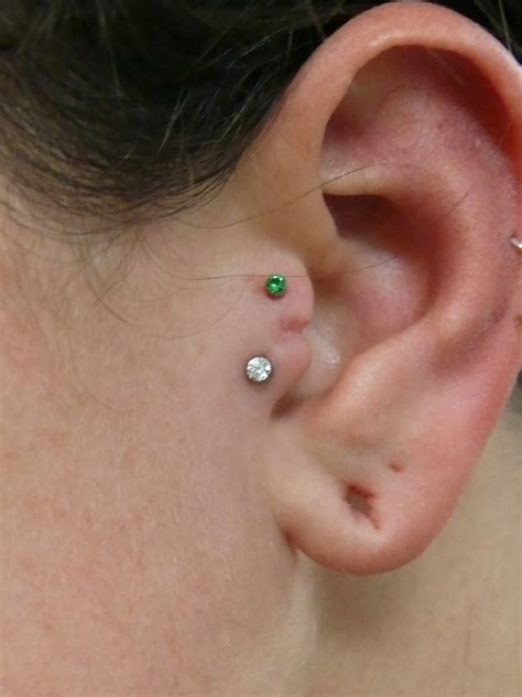 surface tragus|surface tragus dermals.